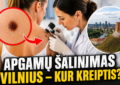 Apgamų šalinimas Vilnius — kur kreiptis dėl konsultacijos?