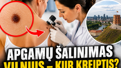 Apgamų šalinimas Vilnius — kur kreiptis dėl konsultacijos?