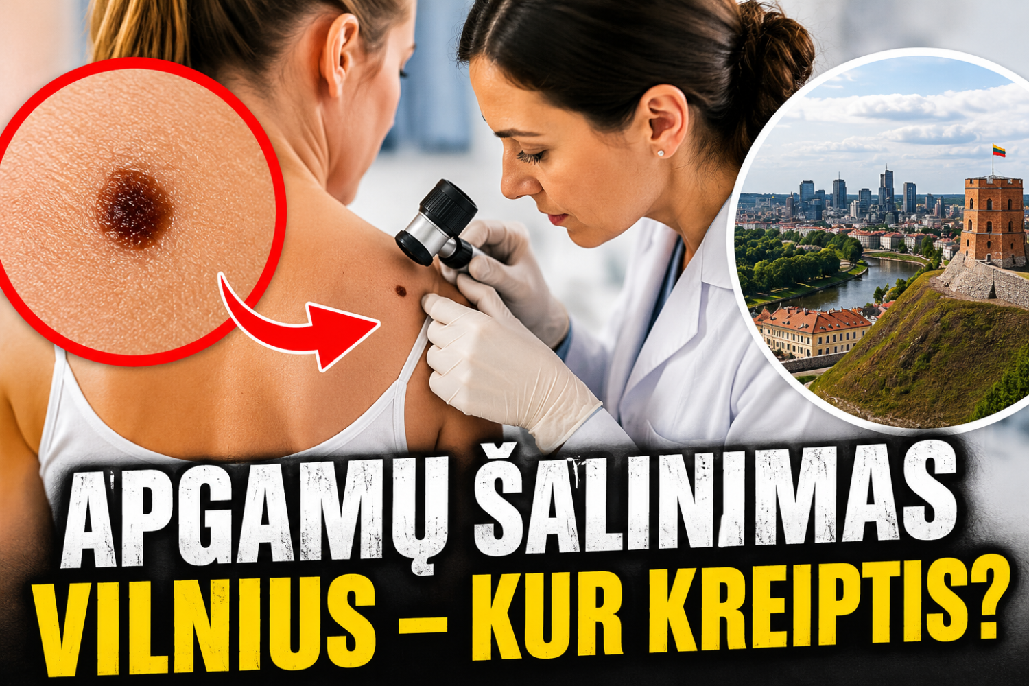 Apgamų šalinimas Vilnius — kur kreiptis dėl konsultacijos?